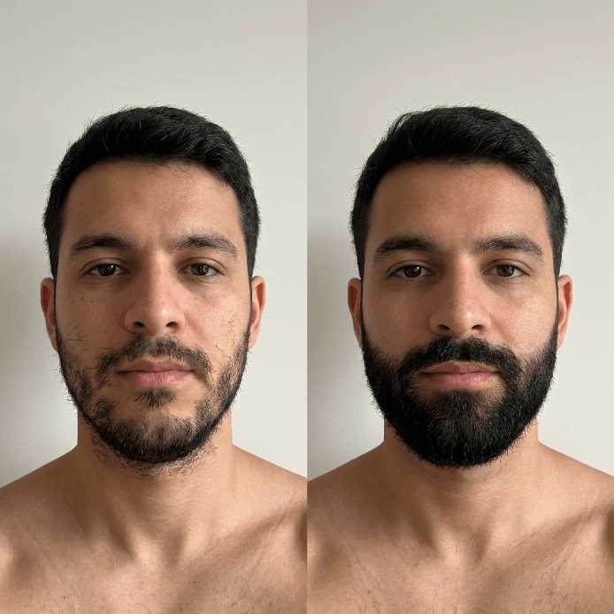 Apolo Ultra Potente — Estimulante de Barba con Minoxidil 20%